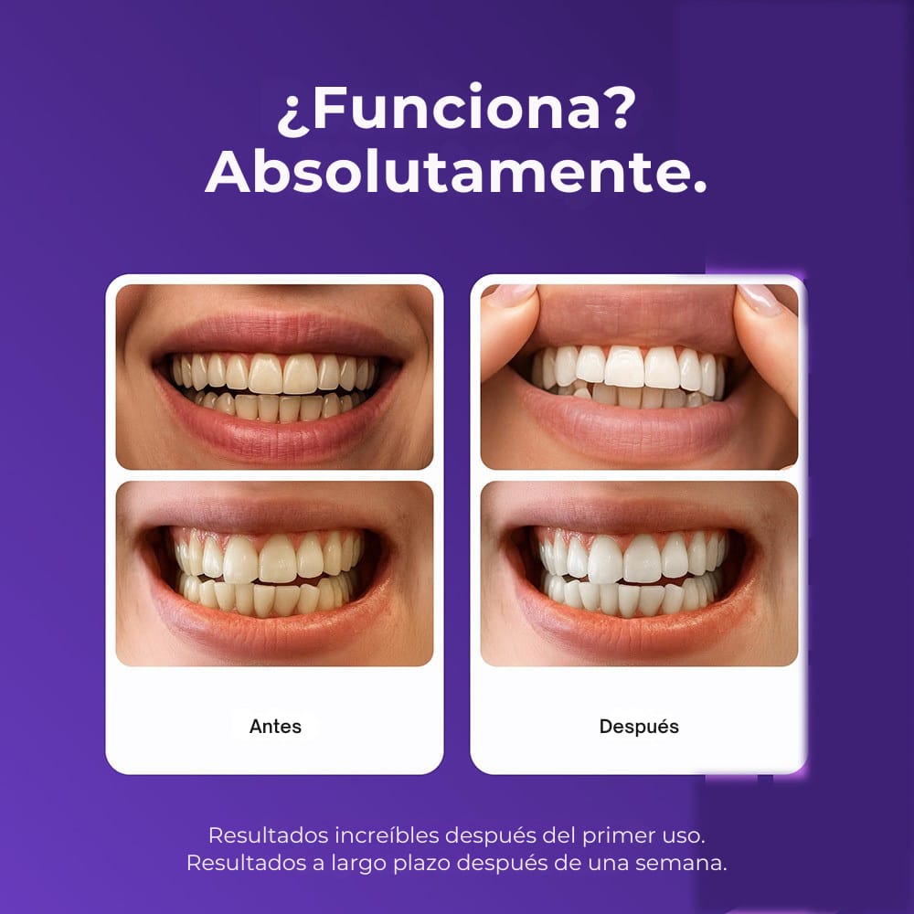 Tiras Blanqueadoras Dentales