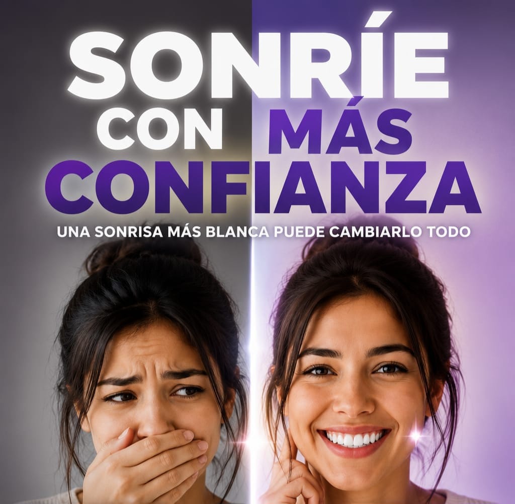 Tiras Blanqueadoras Dentales
